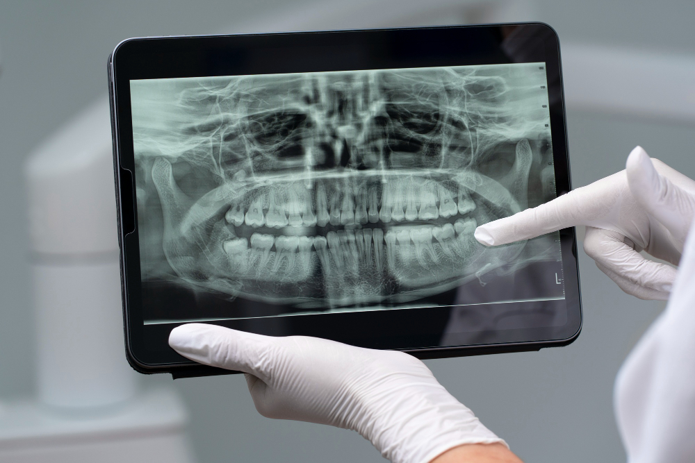 Digital X-Rays  San Clemente, CA