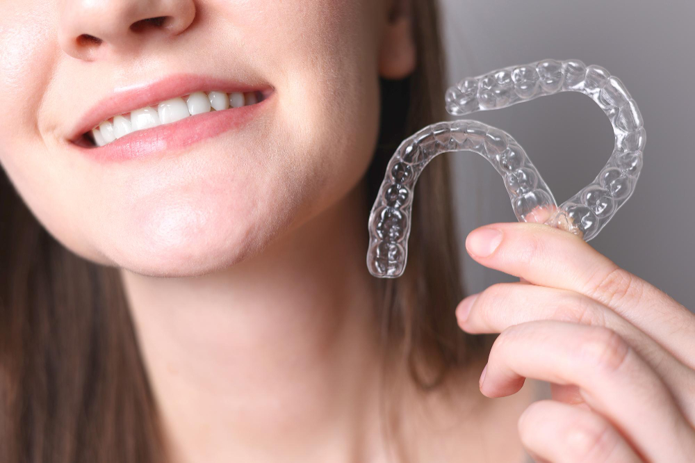 Clear Aligners San Clemente, CA