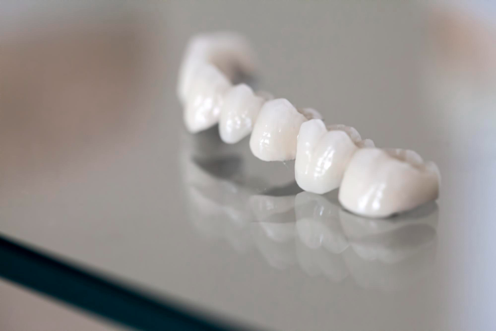 Porcelain Crowns  San Clemente, CA