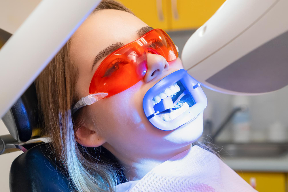Teeth Whitening  San Clemente, CA